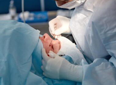 Jakie są różnice w chirurgicznej versus laserowej plastyce powiek?